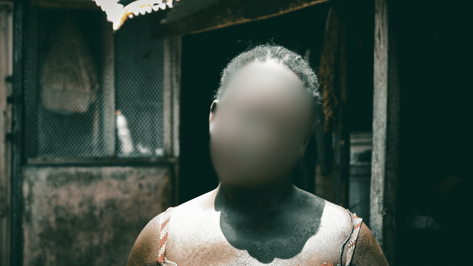 Medical error: Woman can’t control urine after childbirth