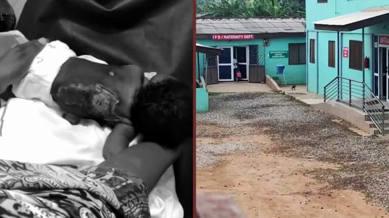 ‘Burnt’ baby: How parents’ joy was cut short after birth